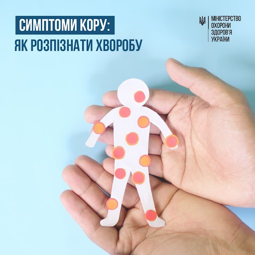 Симптоми кору: як розпізнати хворобу