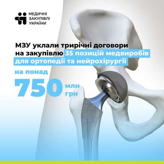МЗУ уклали трирічні договори на закупівлю 35 позицій медвиробів для ортопедії та нейрохірургії на понад 750 млн грн