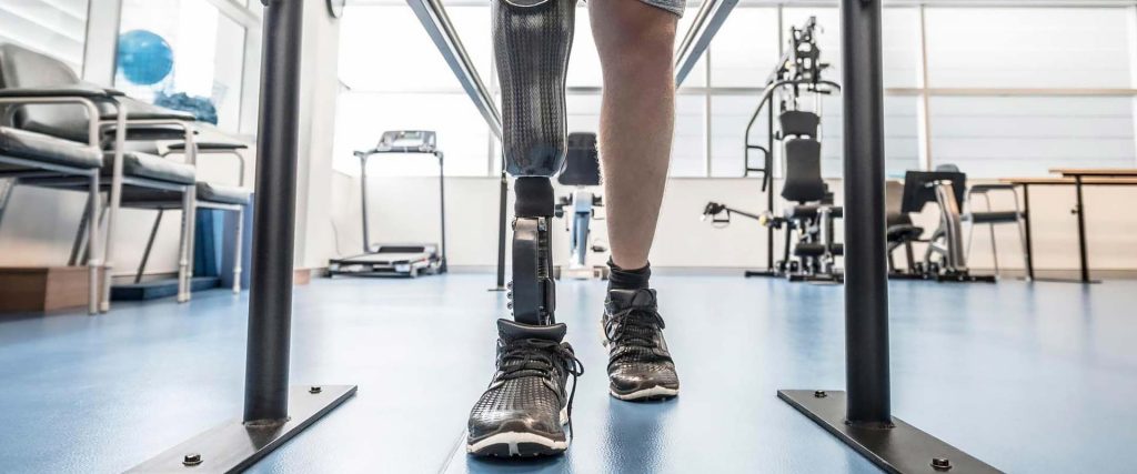 Реабілітація пацієнтів після ампутації